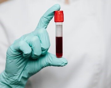 __enfermeira-segurando-um-tubo-de-ensaio-de-sangue_53876-165192 - Na Rua Tem